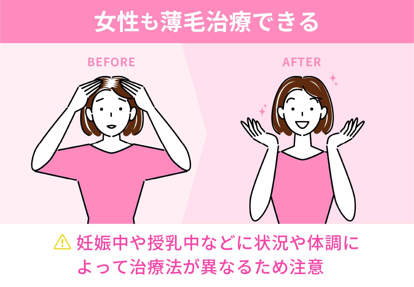 女性も薄毛治療できる（FAGA）