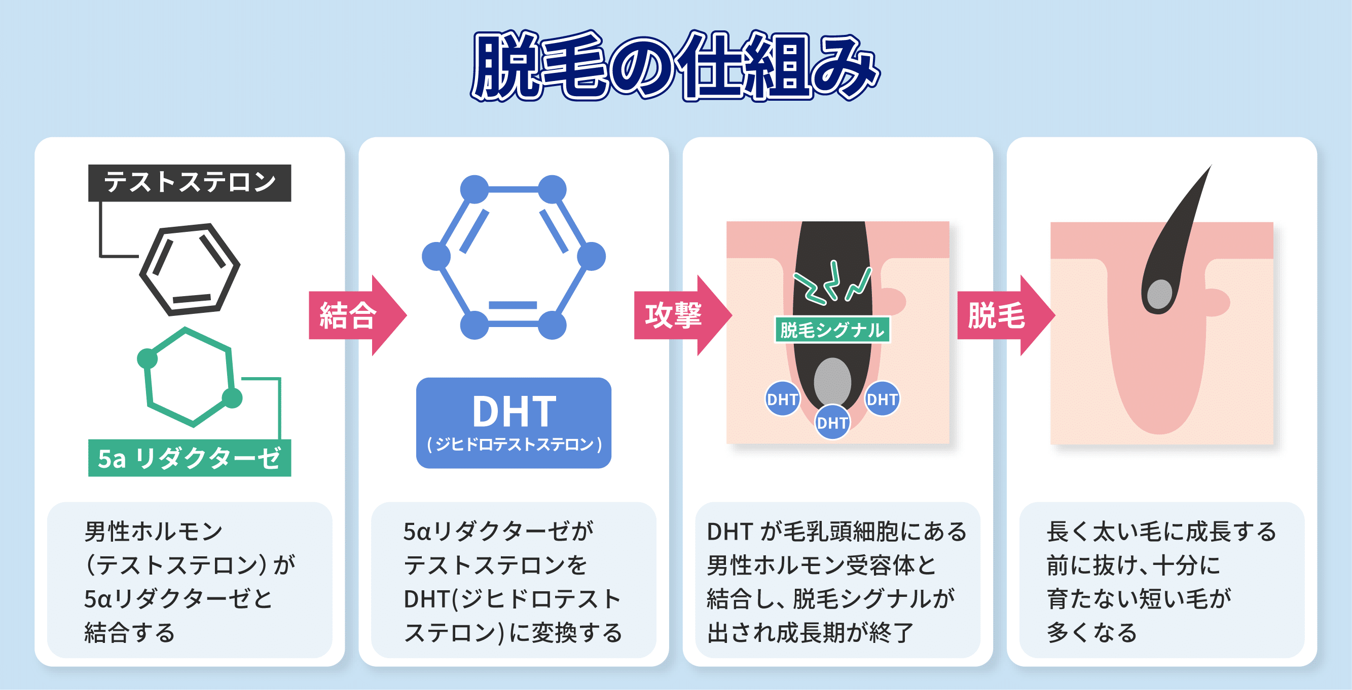 AGAの原因は？