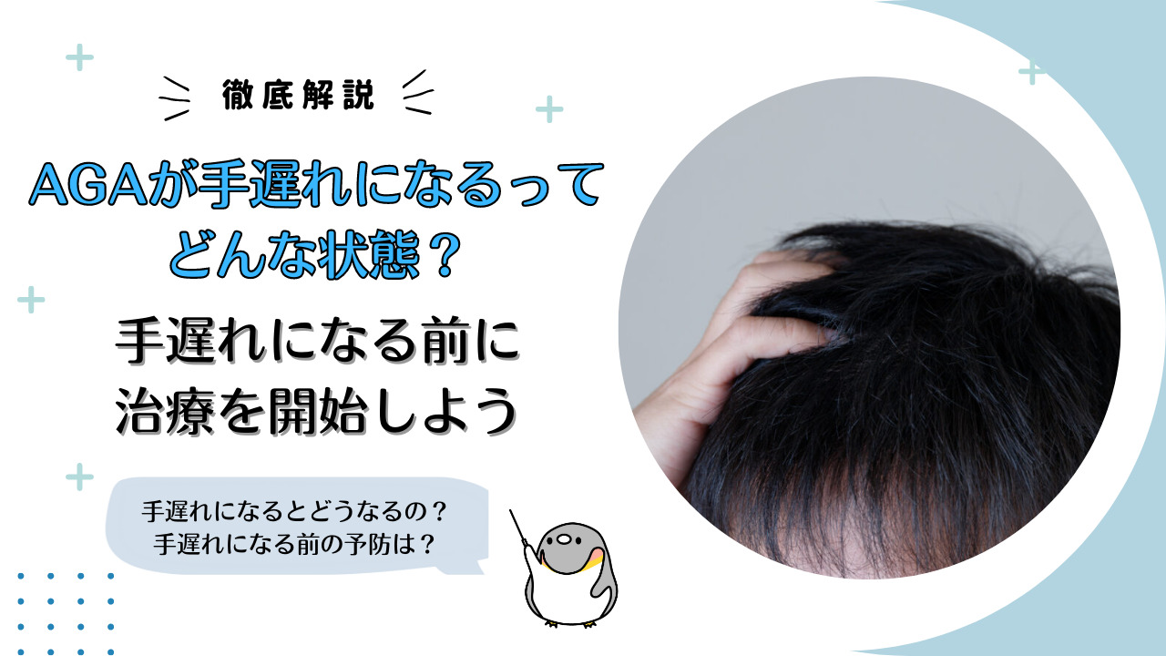 AGAが手遅れになるってどんな状態？手遅れになる前に治療を開始しよう - 名医のチョイス
