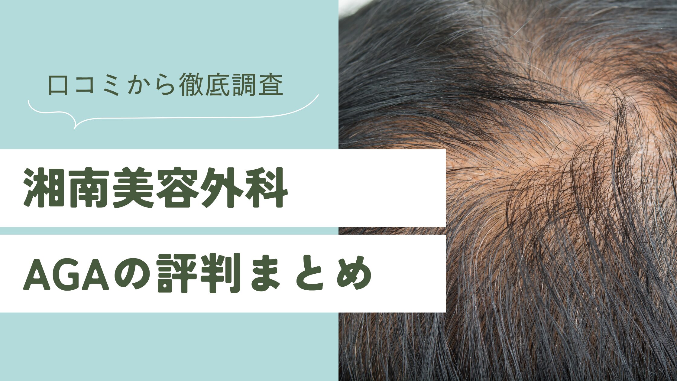 【2025年最新】湘南美容外科のAGAの評判って実際どう？口コミやレビューから真実を徹底調査！
