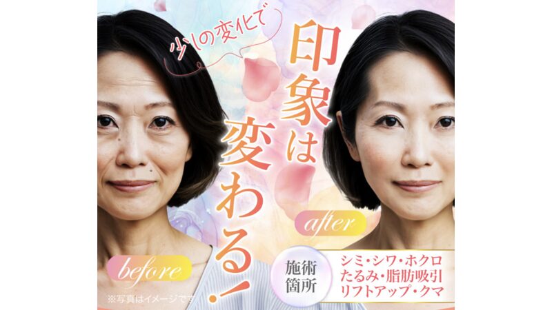 TCB美容外科クリニック